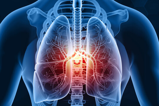 Human lungs diseases, lungs pain. 3d illustration..