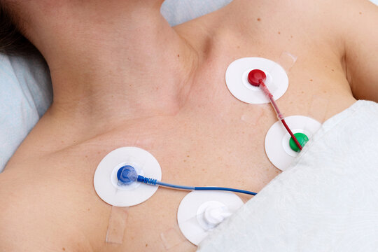 Holter monitoring, electrocardiograph electrodes on female body of patient.