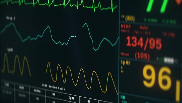 Pulse Test Monitoring Device Displays Stable Life Signs Of Patient. Heartbeat Line On Display Of Pulse Monitoring Medical Equipment. Testing Static Pulse On Display. Healthcare. Hospital
