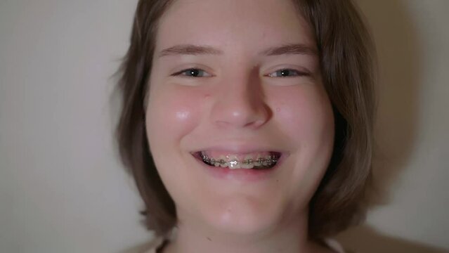 Caucasian positive woman teenager with braces smiling laughing, beauty and dental concept. Happy girl smiling with teeth brackets. Metal self-ligating braces. Orthodontic treatment