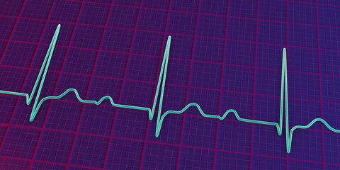 An ECG displaying 1st degree AV block, 3D illustration