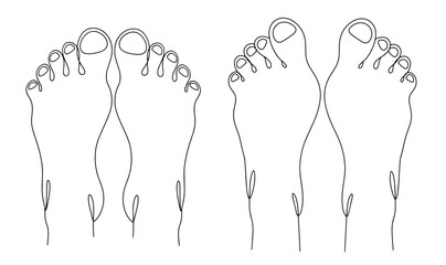 Valgus deformity of the foot. One line