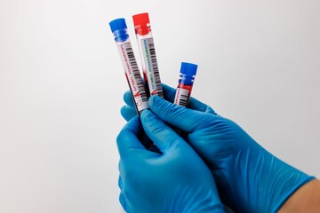 Gloved hand holding three tubes containing blood samples.