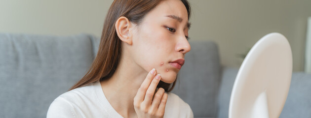 Asian young woman worry about acne on her face after wear face mask. - obrazy, fototapety, plakaty