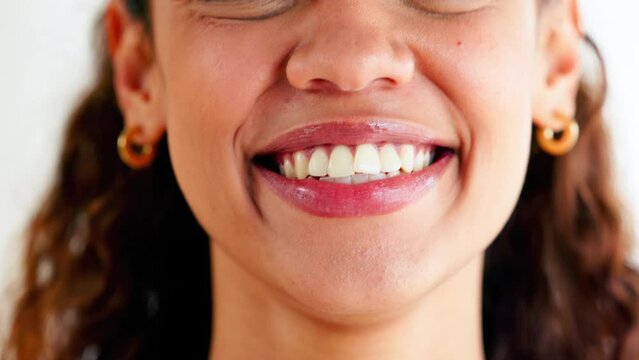 Closeup of laughing woman showing crooked teeth with orthodontic invisible braces to straighten and align. Headshot of smiling, happy and confident lady promoting healthy oral and tooth care routine