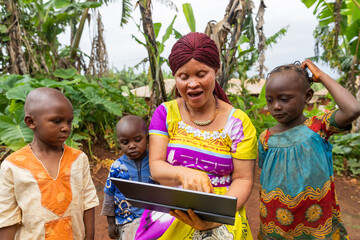 Three children follow attentively what their albino mother is teaching them on the tablet