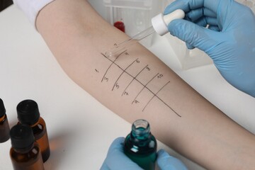 Doctor doing skin allergy test at light table, closeup