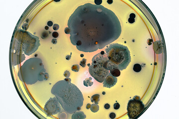 colonies of bacteria and microorganisms on the surface of agar and wind during microbiological...
