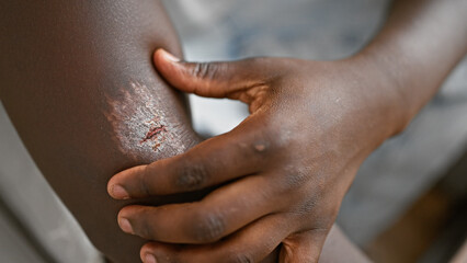 African american man sitting on sofa touching wound on arm at home