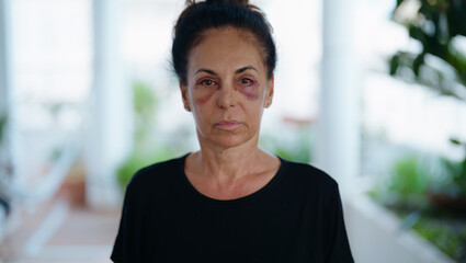 Middle age hispanic woman suffering for domestic violence with bruise on eyes at home terrace - obrazy, fototapety, plakaty