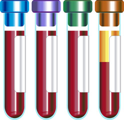 Blood collection tube with cap color indicating it contains heparin EDTA citrate or no anticoagulant