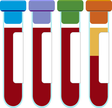 Blood collection tube with cap color indicating it contains heparin EDTA citrate or no anticoagulant