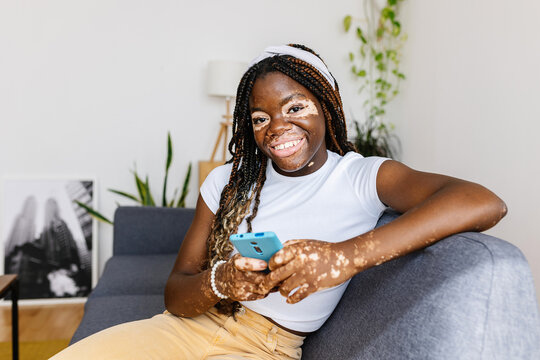 Young african woman with vitiligo smiling at camera while holding mobile phone sitting on sofa at home. Youth, technology and social media concept.