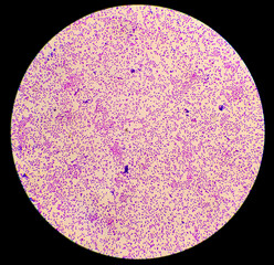 Bacteria colonies gram stained microscopic show Escherichia coli (E.coli) bacteria.