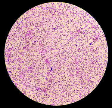 Bacteria colonies gram stained microscopic show Escherichia coli (E.coli) bacteria.