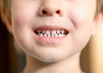 Close up headshot cropped image of little preschool cute boy widely smiling, showing the first baby milk teeth. Happy four years old small adorable cutie toddler with primary teeth.