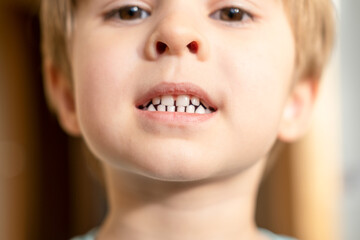 Close up headshot cropped image of little preschool cute boy widely smiling, showing the first baby milk teeth. Happy four years old small adorable cutie toddler with primary teeth.
