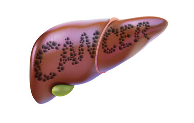 3D illustration of the liver and gallbladder with the word cancer presented for quick understanding. For medical, educational, advertising, scientific and industrial use.