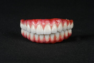 composition of dental prostheses on a black background