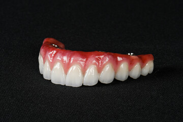 realistic dental permanent prosthesis upper jaw with a blank black background