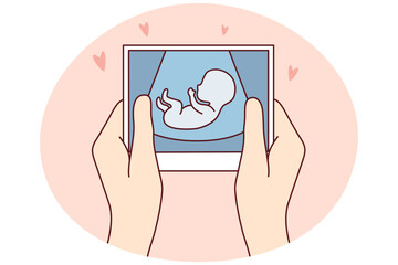 Hands of person holding scan of embryo waiting for baby birth. Future mother with ultrasound picture of baby. Motherhood concept. Vector illustration.