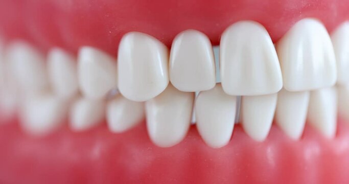 White beautiful even teeth with correct bite on artificial jaw. Dental clinic services concept