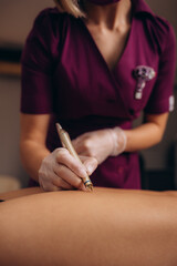cosmetic removal of blood vessels on the leg in a beauty salon