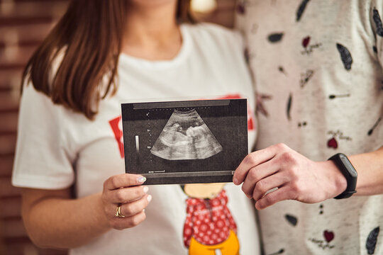 Pregnant lovely couple showing ultrasound scan photo of unborn child
