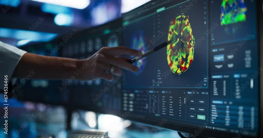 Poster Modern Medical Research Center: Anonymous Doctor Pointing At Desktop Computer Monitor With Software Visualizing Human Brain Based On MRI Scan. Neurologist Looking For Impacted Areas By Brain Damage.
