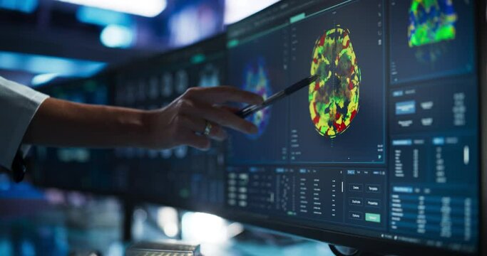 Modern Medical Research Center: Anonymous Doctor Pointing At Desktop Computer Monitor With Software Visualizing Human Brain Based On MRI Scan. Neurologist Looking For Impacted Areas By Brain Damage.