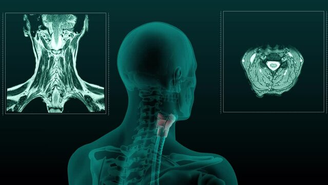 X-ray scan of the human head and neck with the Larynx visible. 3d render animation of rotation.