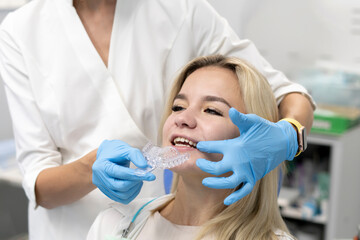 otrhodontist making teeth impression mold in a plastic tray, orthodontic treatment concept - obrazy, fototapety, plakaty
