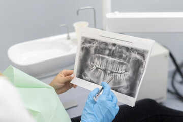 Fototapeta na wymiar female dentist doctor with x-ray of client's teeth shows it to her