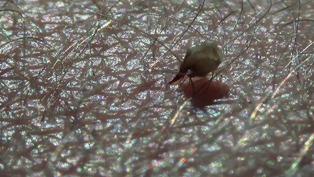 Bee's venom sac. Honey bee stings a man's arm. When the sting is over, the honeybee leaves the venom sac, notices it's still injecting the venom on its own by the pressure of the surrounding muscles