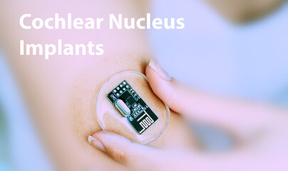 Cochlear Nucleus Implants Implantable Electronic Medical Devices Conce