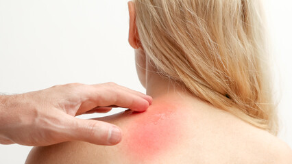 Man applying pain relieving cream, gel on woman's neck on white background. Pain relief and health...