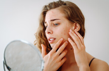 Dermatology. A beautiful woman looking in the mirror, touching her face with her hand, examines...