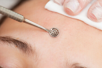 Close up of procedure of cleaning skin with steel tool in beauty salon. Cosmetologist making...