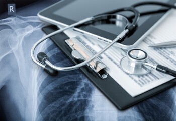 Medical Stethoscope on  X-ray photo of a patient. - obrazy, fototapety, plakaty