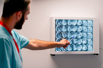 The radiologist carefully studies the MRI image on a special board describes what he saw and writes diagnosis conclusion