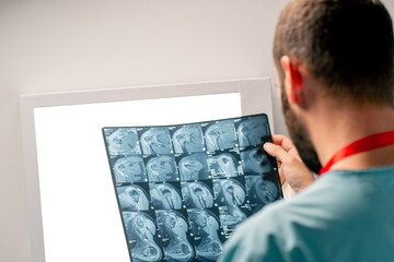 A close-up frame of an MRI image on a special board for an accurate and detailed description of...