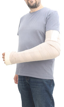 fracture in the arm bandaged and wrapped in a brace