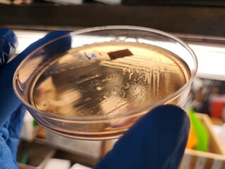 Petri dish with yellowish clear colonies of Shigella flexneri