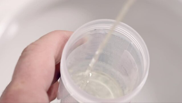 Collecting a urine sample at the doctor's office or for drug testing