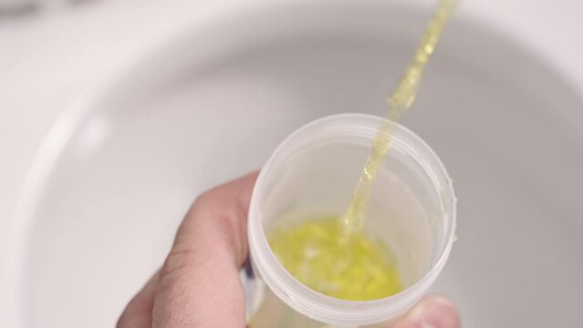 Providing a urine sample for doctor visit or urinalysis drug test
