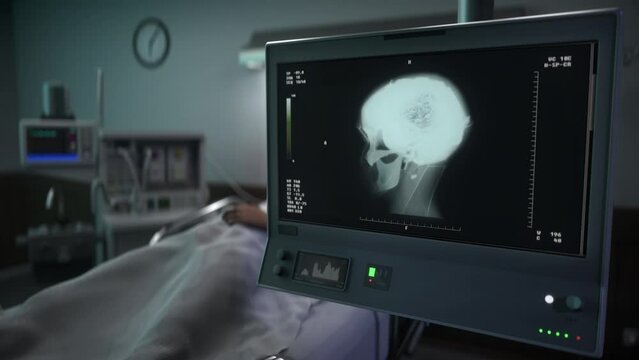 Radiology device used for diagnosis of the emergency patient brain organ. Radiology examination of the damaged brain to set a diagnosis. Radiology inspection of injured brain for sickness diagnosis.