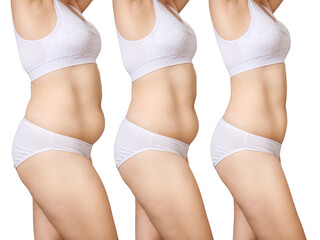 Woman's body before and after weight loss.