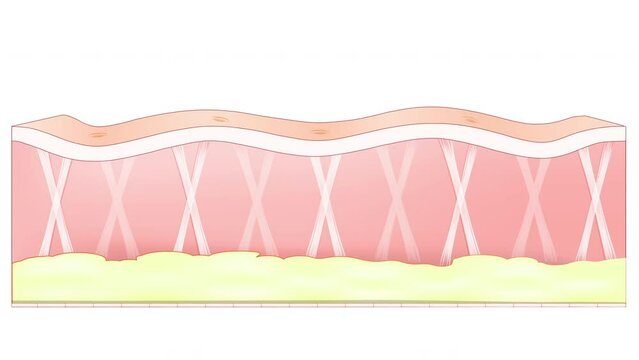 Collagen fibers support to the skin, and their reduction lead to the formation of wrinkles