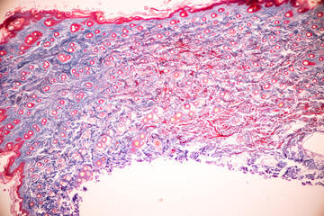 Characteristics Tissue of Human scalp, Skin human from general body surface and showing sweat...