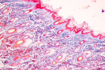 Characteristics Tissue of Human scalp, Skin human from general body surface and showing sweat...
